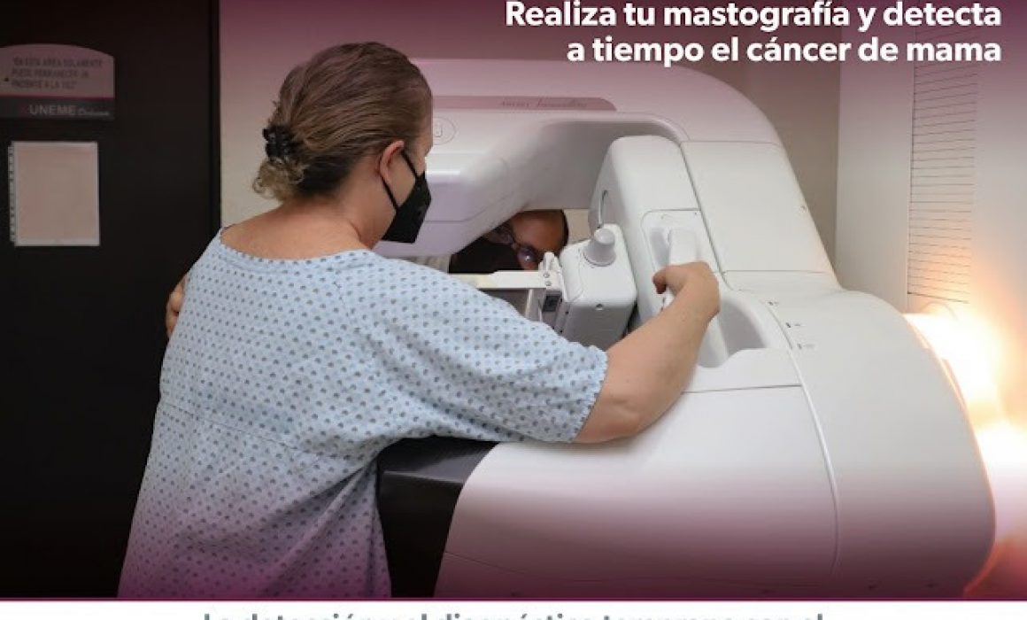 mastografia