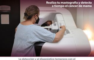 mastografia